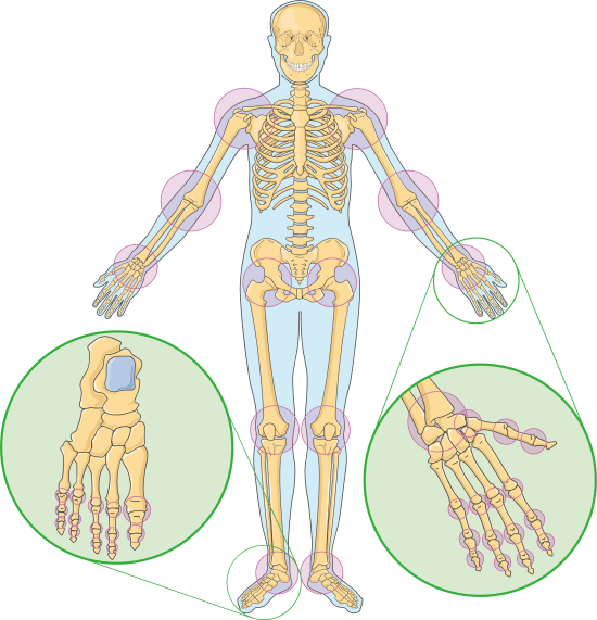 Joints_1_--_Smart-Servier